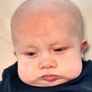 Meet your Posher, Meadow